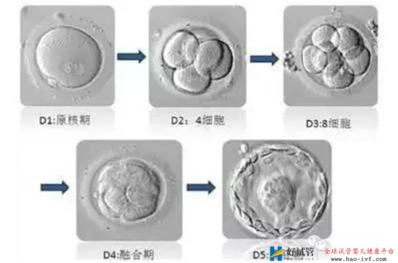 看完这篇试管婴儿养囊的利弊,你会继续选择养囊吗?(图2) 看完这篇试管婴儿养囊的利弊,你会继续选择养囊吗?(图2)