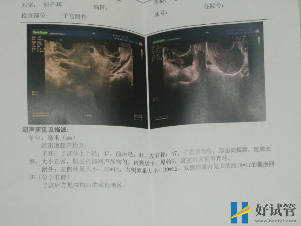 保山施甸县试管婴儿哪个医院好?(图1) 保山施甸县试管婴儿哪个医院好?(图1)